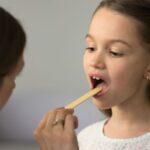 Bacterial tonsillitis in children