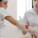 Prevencija hemoragijske bolesti novorođenčeta